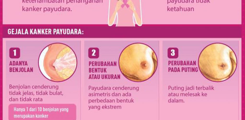 apa penyebab kanker payudara